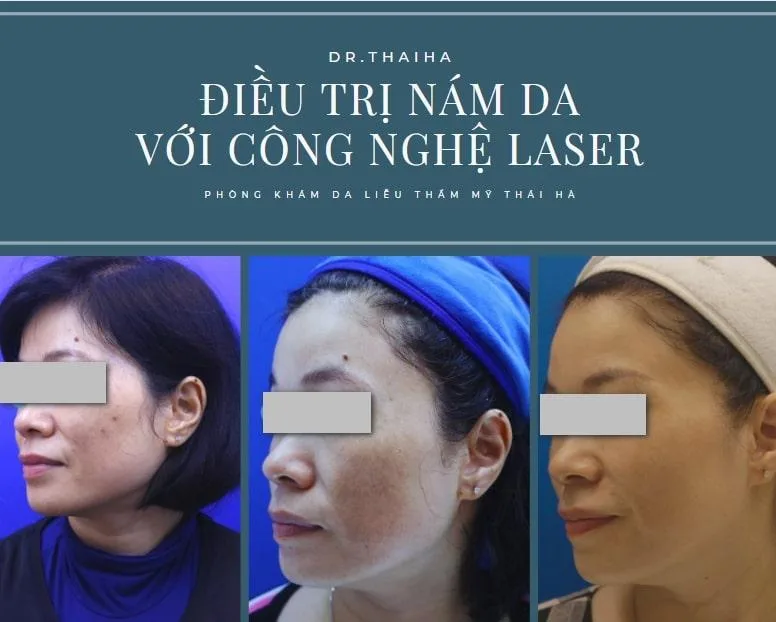 Phòng khám Da liễu Thẩm mỹ Thái Hà (Dr.thaiha)