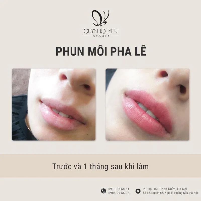 QuynhQuyen Beauty Center